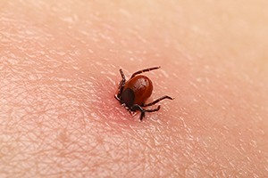 Are Tick Bites Dangerous? in your area